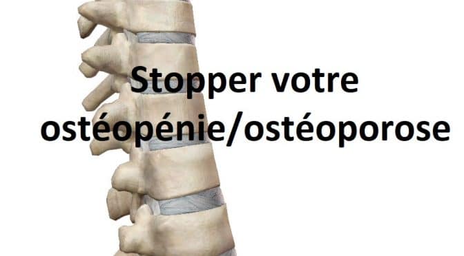 Comment stopper votre ostéopénie ou votre ostéoporose
